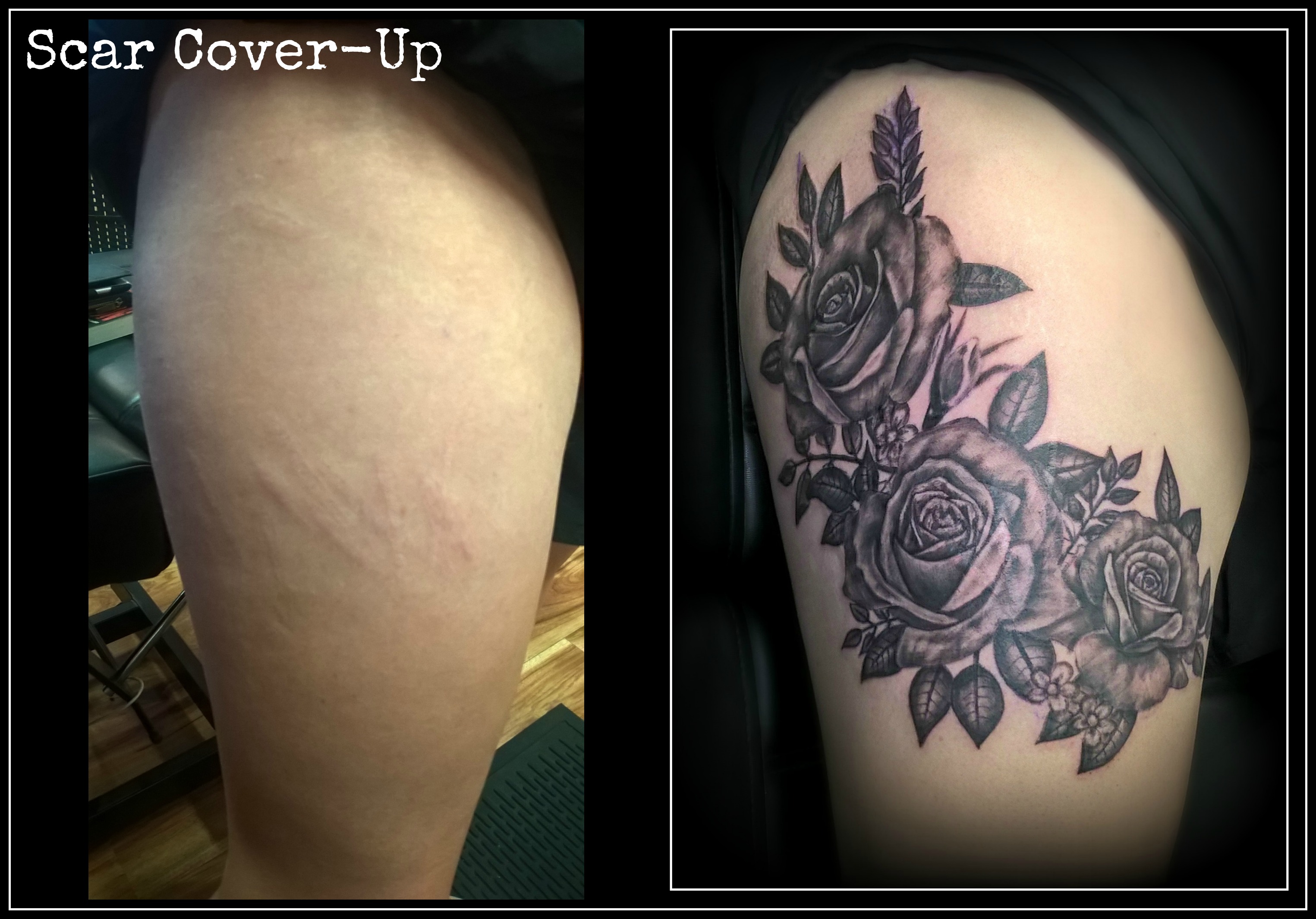 Tattoo Covering Scars on Legs